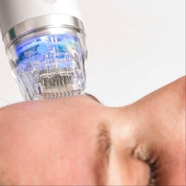 Radiance Revive Package at Ush Beauty & Wellness Lounge in North Potomac, MD