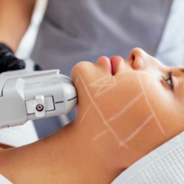 Jawline Sculpt Package at Ush Beauty & Wellness Lounge in North Potomac, MD
